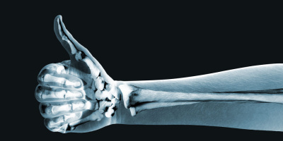 Запись вебинара «Эндопротезирование суставов у пациентов с ревматологическими заболеваниями: как снизить риск осложнений» 16 октября