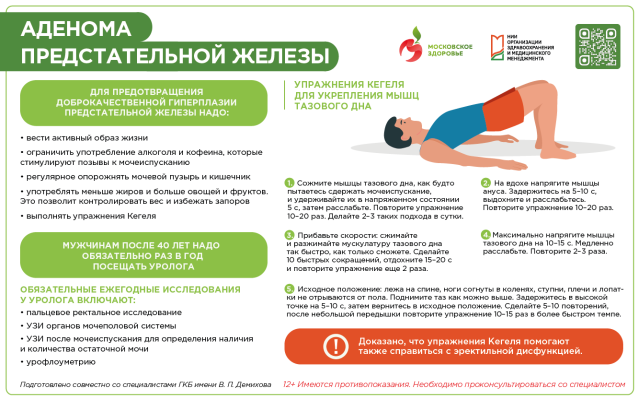 Аденома предстательной железы