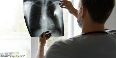 Всемирный день борьбы с туберкулёзом: знания спасают жизни