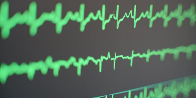 В Москве стартовал цикл школ сердечно-сосудистых хирургов