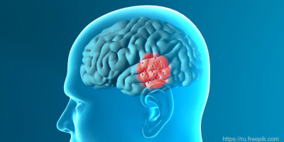 Запись онлайн-лекции «Отек головного мозга» 13 октября