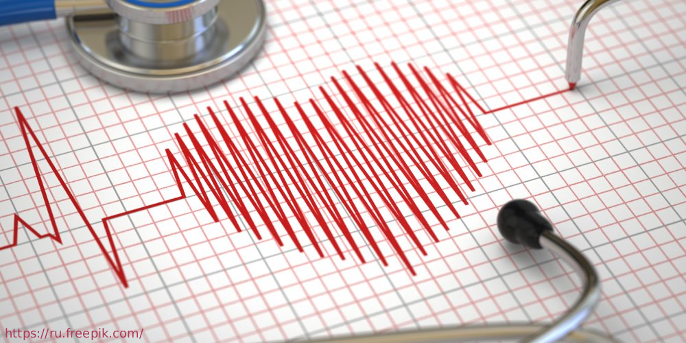 Исследование по оценке качества медицинской помощи пациентам с сердечной недостаточностью