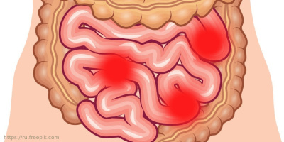 Антибиотикоассоциированные поражения кишечника в свете распространения COVID-19