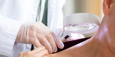 Роль телемедицины в дерматологии с примерами по организации услуг пациентам с псориазом и акне