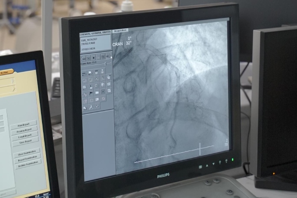 Лечение аневризмы с помощью нанороботов (Китай, Шотландия) 