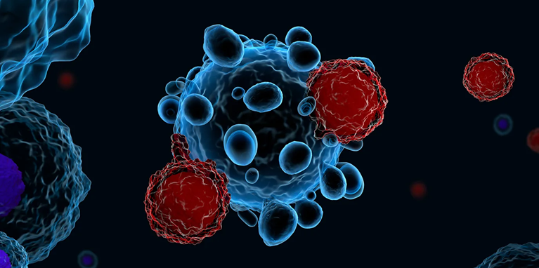 Итоги вебинара по CAR Т-клеточной терапии В-клеточной неходжкинской лимфомы