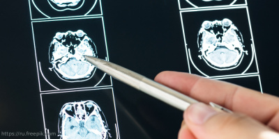 Вебинар «Возможность использования МРТ и фМРТ в работе психолога и логопеда», 26 августа 2022 года