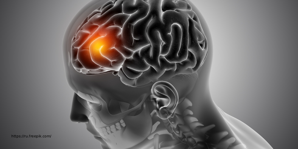 Технология реабилитационных (сенсорных/полисенсорных) перчаток 