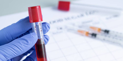 Научно-практическая конференция «Эозинофилии – алгоритм диагностики от анализа крови к диагнозу», 22 декабря 2021 года