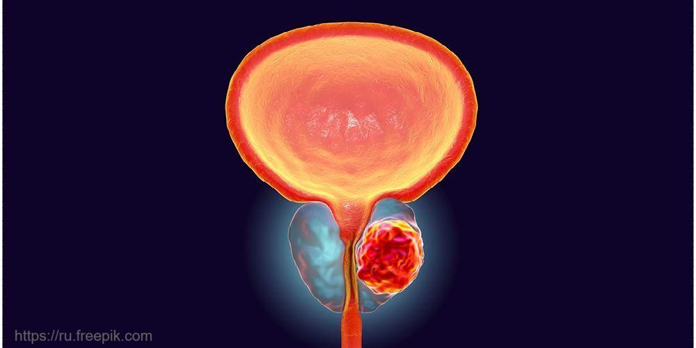 Клиника урологии под руководством главного уролога ДЗМ направила работу на Премию Москвы в области медицины