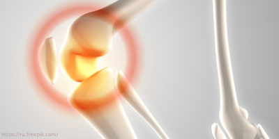 Онлайн-семинар «Медицинская реабилитация после эндопротезирования суставов нижних конечностей», 17 апреля 2024 года