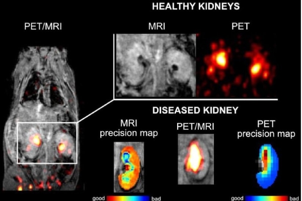 Новое контрастное вещество для ПЭТ/МРТ (Германия, Чехия) 