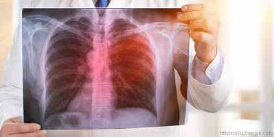 Вебинар «Вопросы аудита качества оказания медицинской помощи при наиболее частых видах злокачественных опухолей», 16 сентября