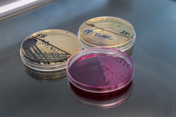 База данных онкологических пациентов с учетом региональных особенностей (Индия)