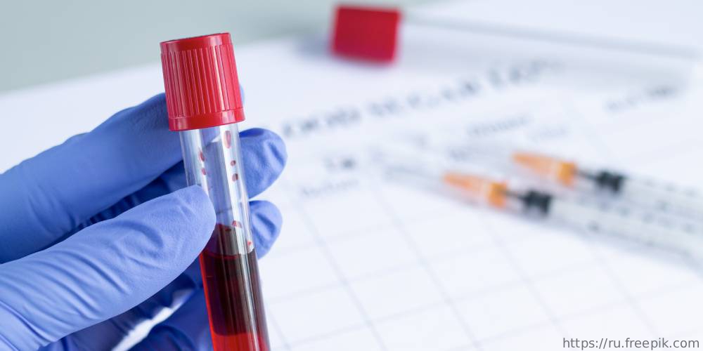 Научно-практическая конференция «Эозинофилии – алгоритм диагностики от анализа крови к диагнозу», 22 декабря 2021 года