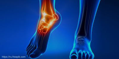 Запись вебинара «Хирургическое лечение патологии стопы» 5 октября