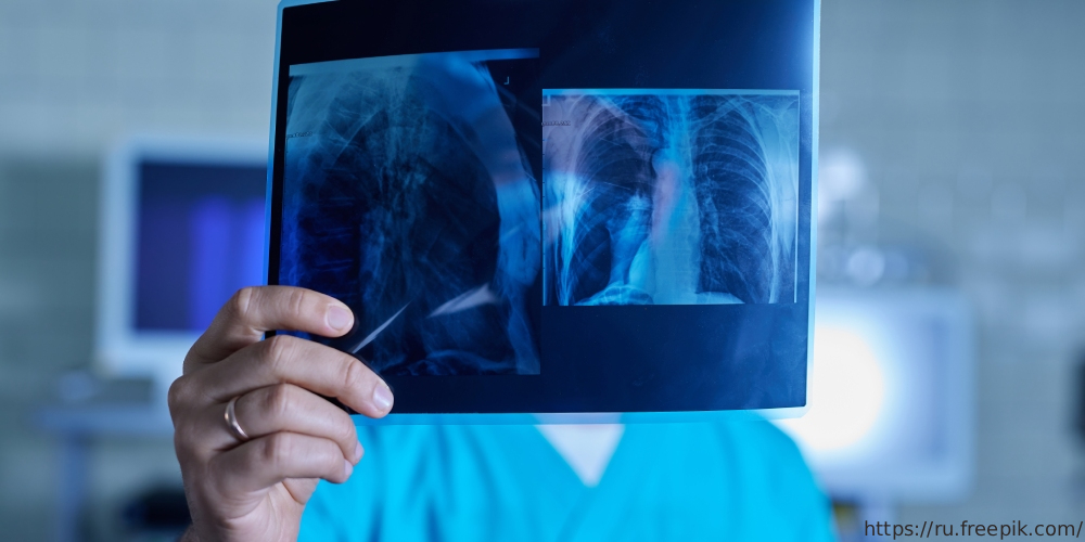 Вебинар «Диагностика интерстициальных изменений легких в практике ревматолога и терапевта», 17 апреля 2025 года