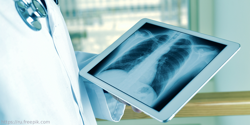 Онлайн-стажировка торакальных хирургов и трансплантологов