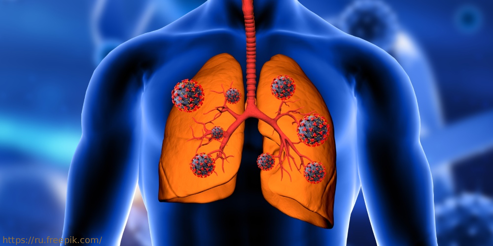 Семинар «Мониторинг эпидемических очагов туберкулезной инфекции и латентной туберкулезной инфекции», 9 апреля 2025 года