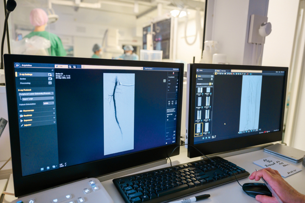 20250924-гибридная операционная, оборудование, приборы-16.jpg 20250924-гибридная операционная, оборудование, приборы-16.jpg